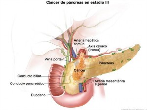foto11-300x224
