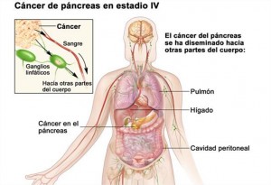 foto12-300x205