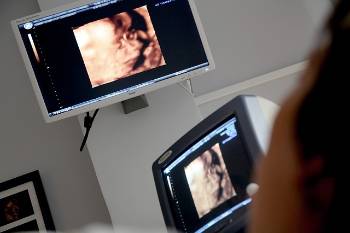 Diagnóstico Prenatal