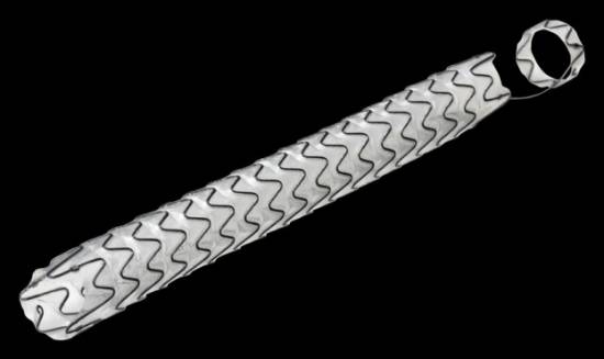 Fig20.-Stent-uretral