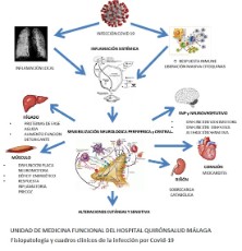 INFOGRAFÍA MEDICINA FUNCIONAL QUIRÓNSALUD MÁLAGA. FISIOPATOLOGÍA Y CUADROS CLÍNICOS DE LA INFECCIÓN POR COVID-19