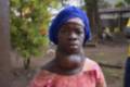 paciente tiroide sierra leona antes de ser operada