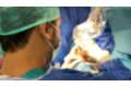 Blefaroplastia sin cirugía - Dr. Salvador Molina - Oftalmología 3