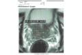 imagen_biopsia_por_fusión