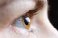 FOTO_OJO_CORNEA