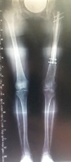 femoral-09-
