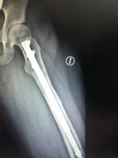 femoral-08-