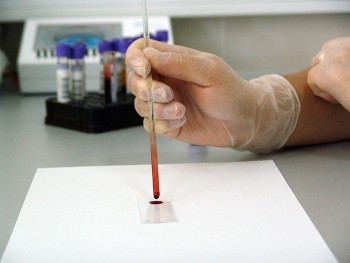 Hematología