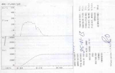 Fig1-Registro-en-papel-de-una-flujometria-con-curvas-de-miccion-normal