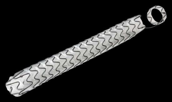 Fig20.-Stent-uretral