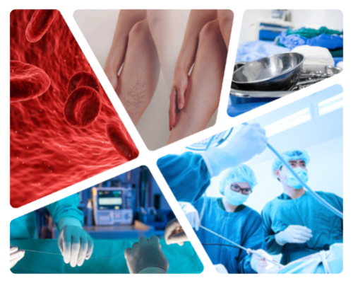 angiologia-cirugia-vascular-hospital-quironsalud-marbella