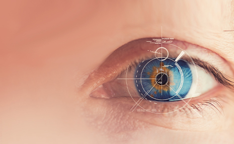 lentes_icl_quironsalud_marbella