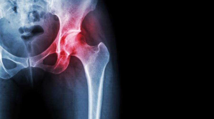Patología Osteomuscular