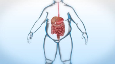 Método_apollo_quironsalud_marbella