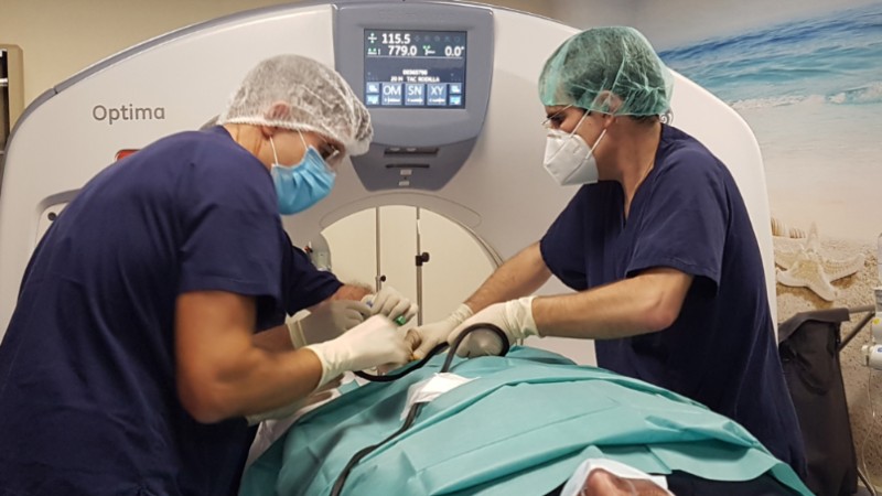 ablacion_quironsalud_marbella1