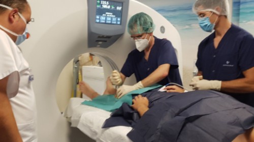 ablacion_quironsalud_marbella2