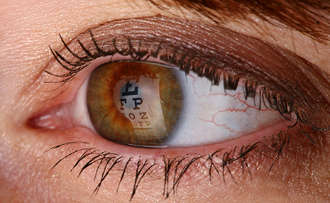 ojo web 2