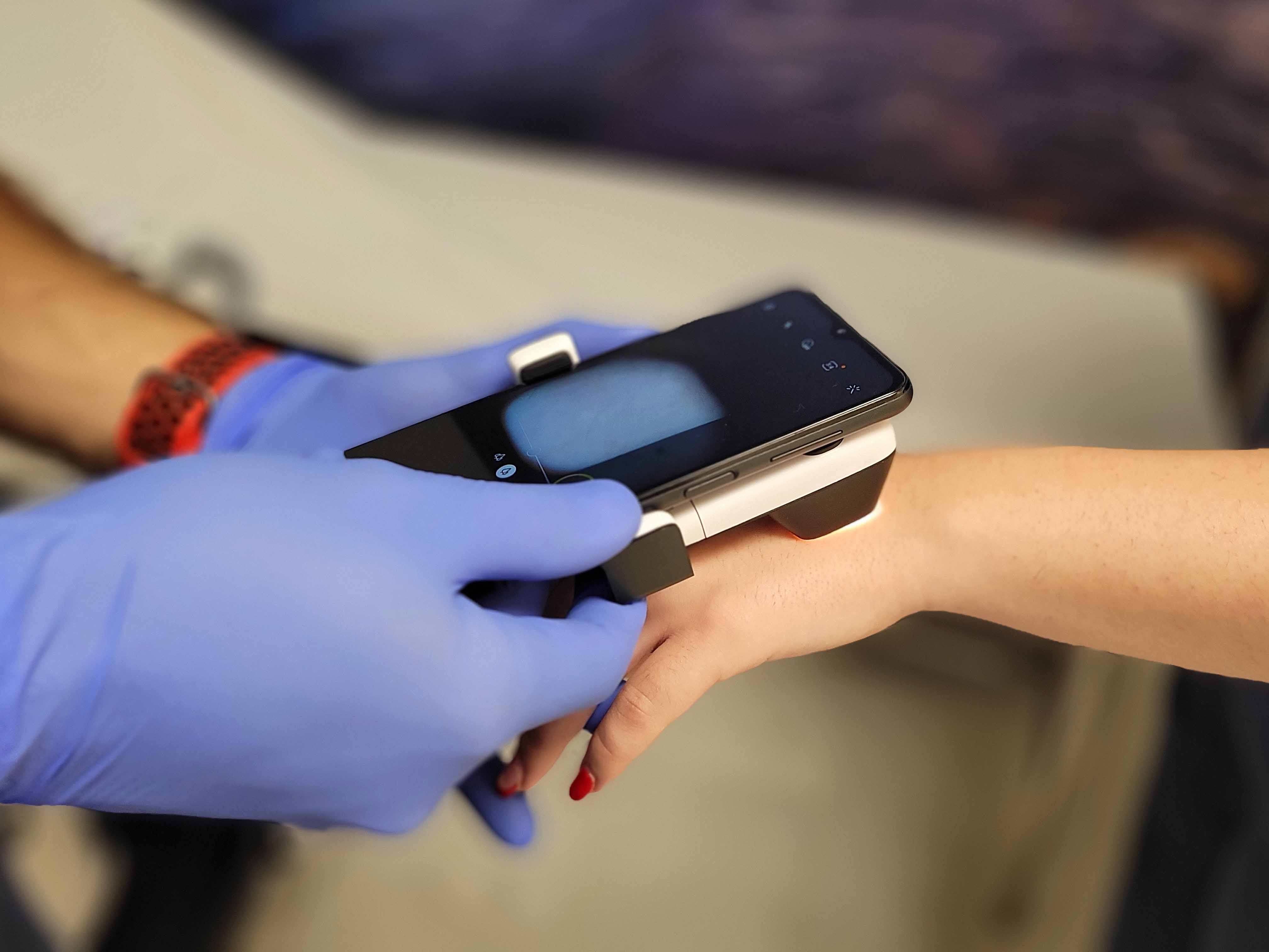 teledermatologia_quironsalud_marbella_b