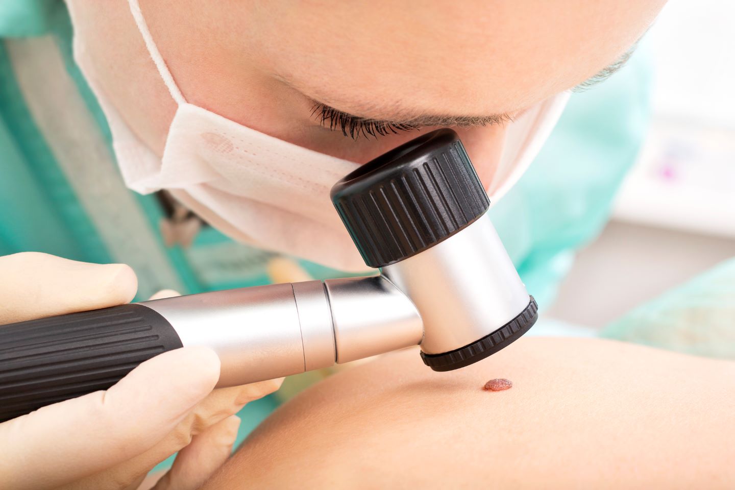 1440 Dermatología - Cáncer de piel