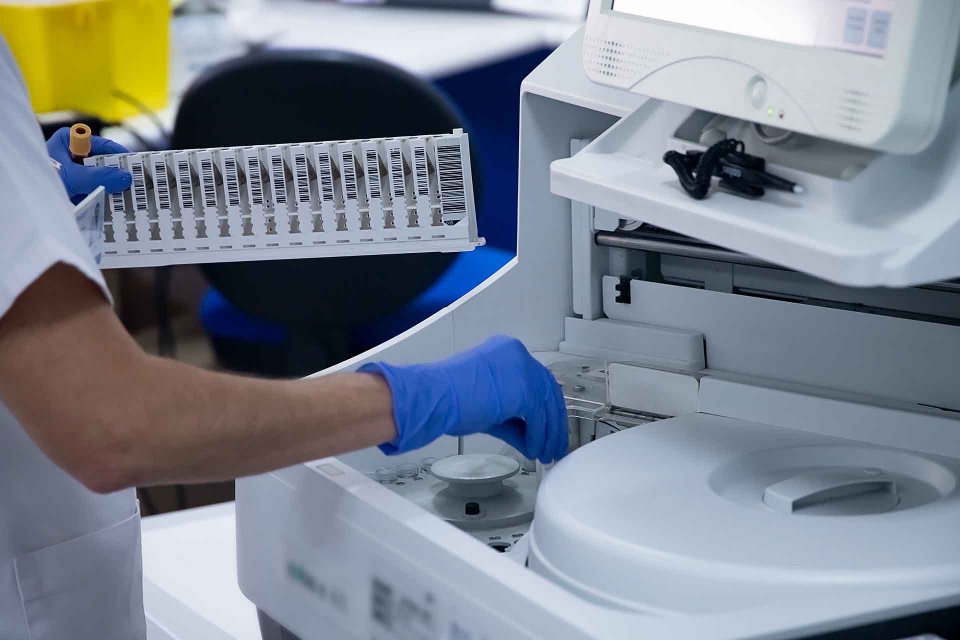 posvacunacion_covid_laboratorio_quironsalud_marbellaw