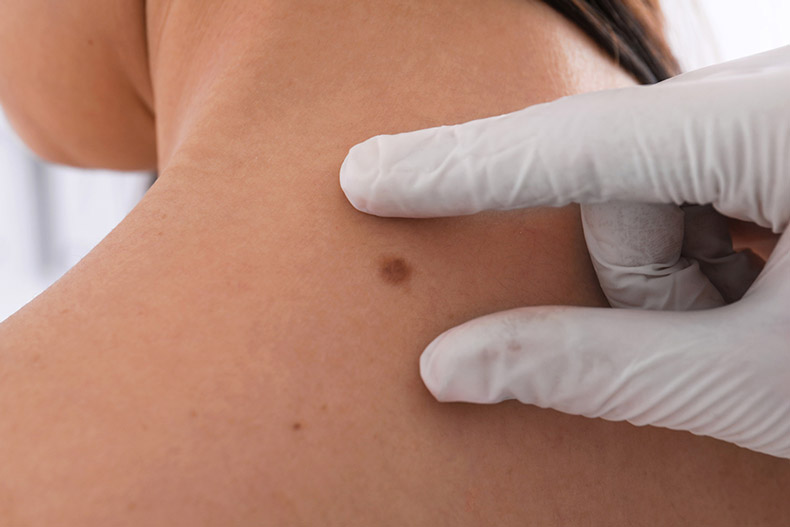 Dermatología