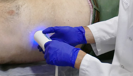 trastorno metabólico asociado a esteatosis hepática