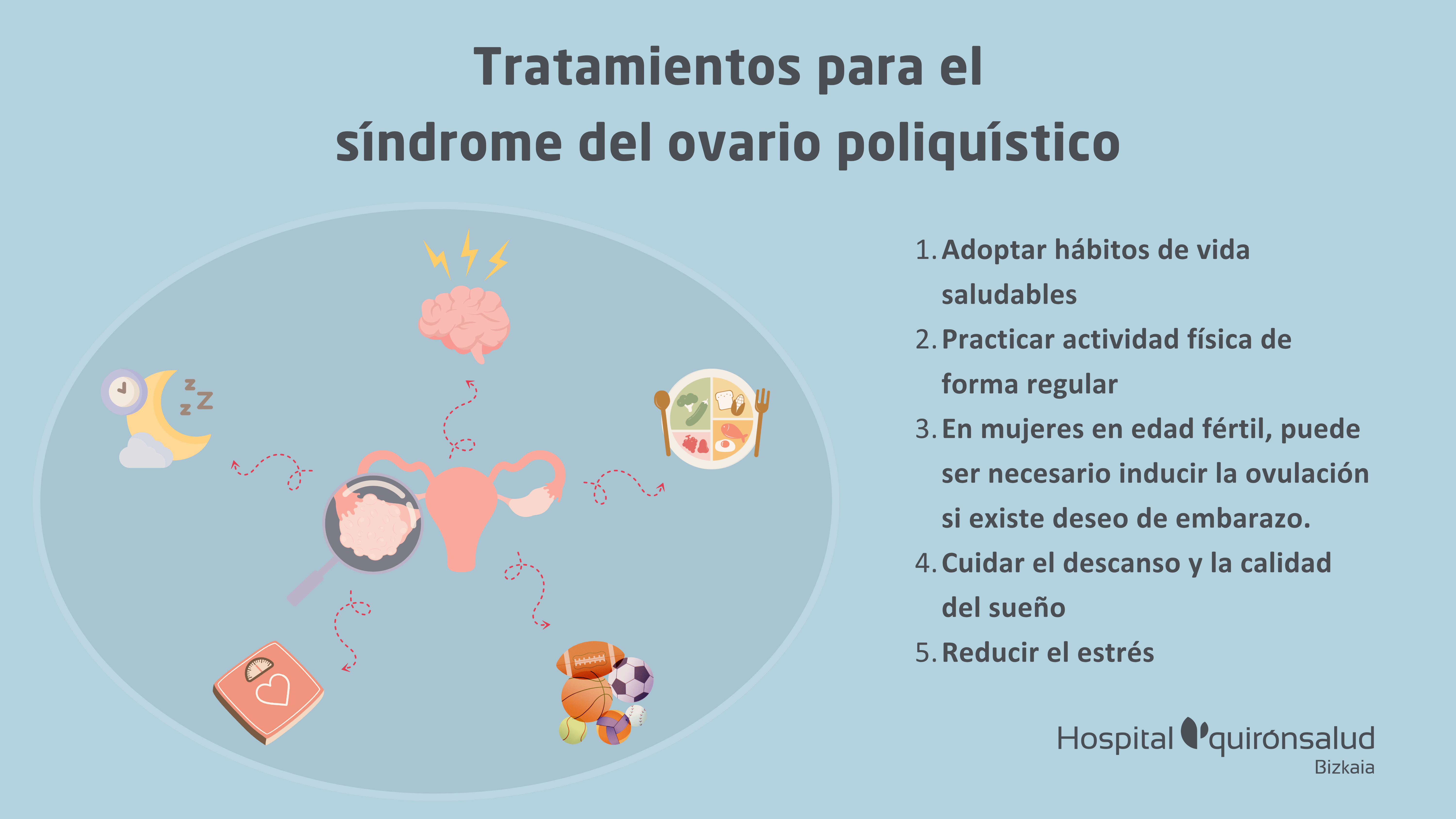 2. NdP Síndrome de Ovario Poliquístico
