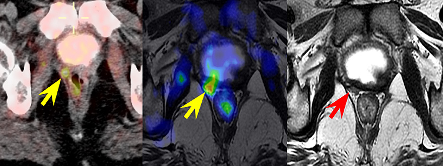 imagenprostata
