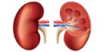 Insuficiencia renal