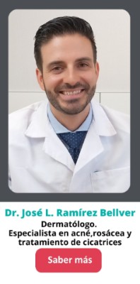 Tratamiento del acné. Docto0 Ramirez Bellver