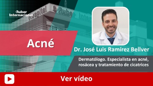 Acné diagnóstico y tratamiento. This link opens in a popup window