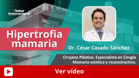 Hipertrofia mamaria. This link opens in a popup window