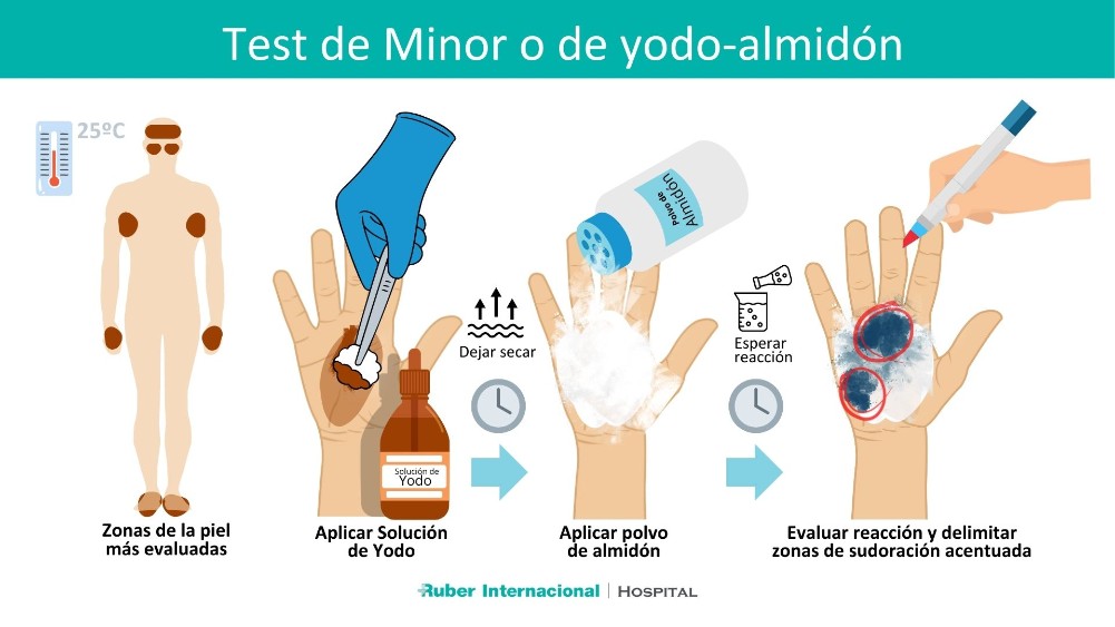 Test de Minor Prueba de Yodo Almidón para Diagnóstico de Hiperhidrosis