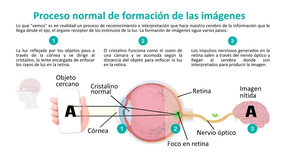 Presbicia RuberInternacional FormaciondeImagenes