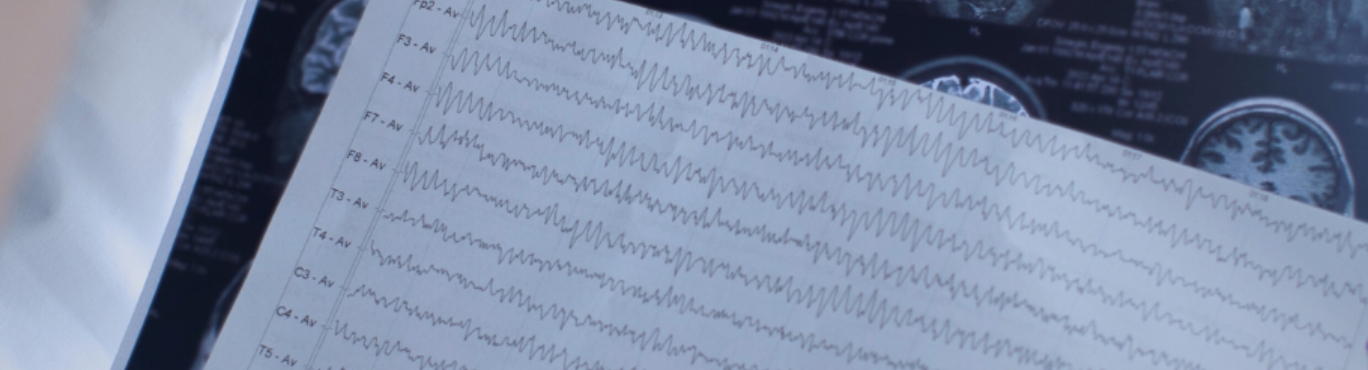 Cirugía de epilepsia