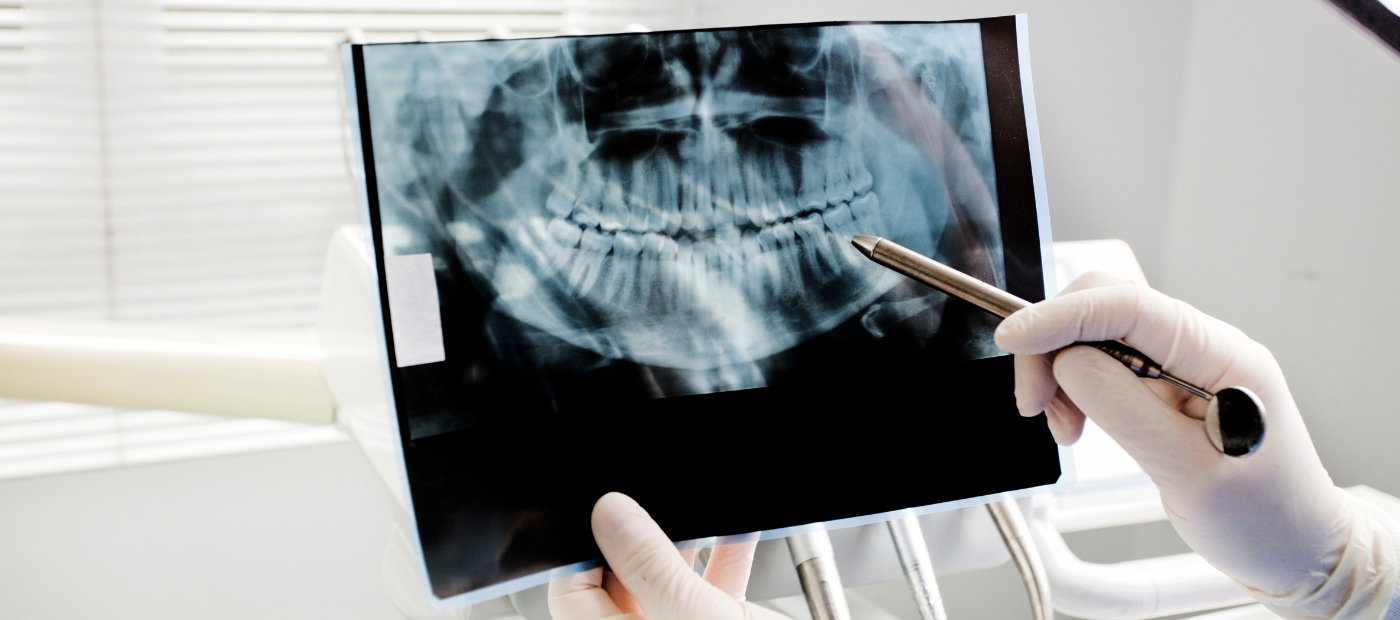 Cirugía oral y maxilofacial