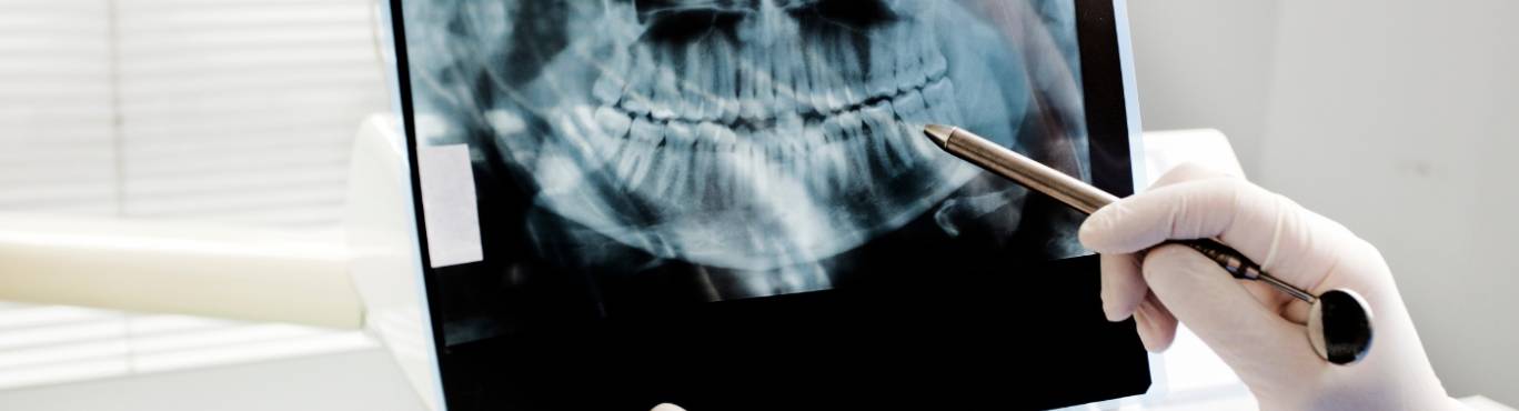 Cirugía oral y maxilofacial