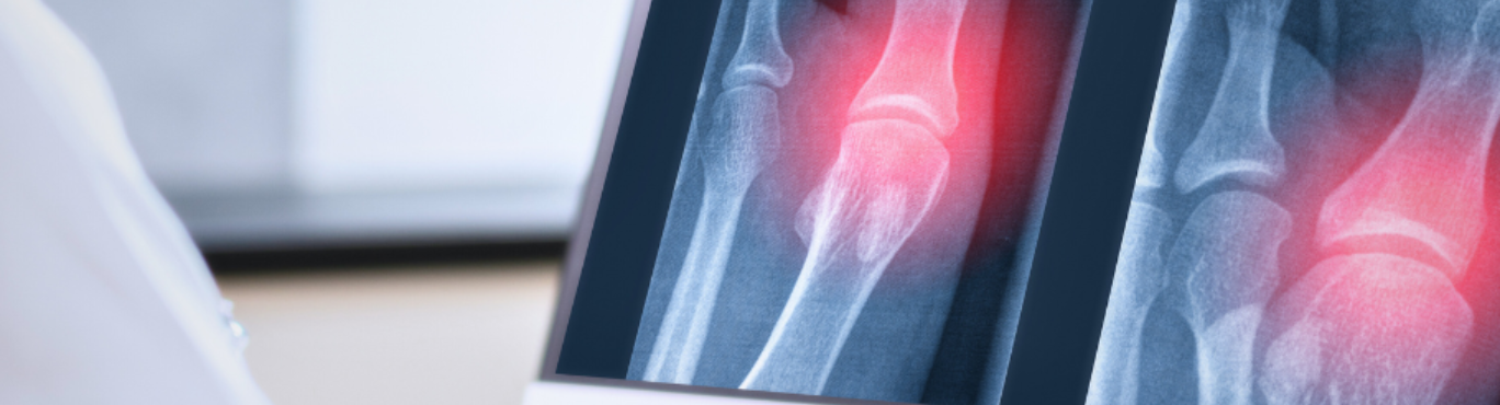 Unidad de sarcoma Ruber