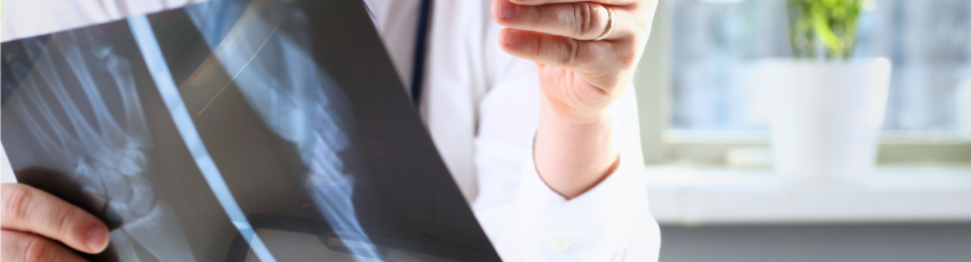 Traumatología Ruber internacional Madrid