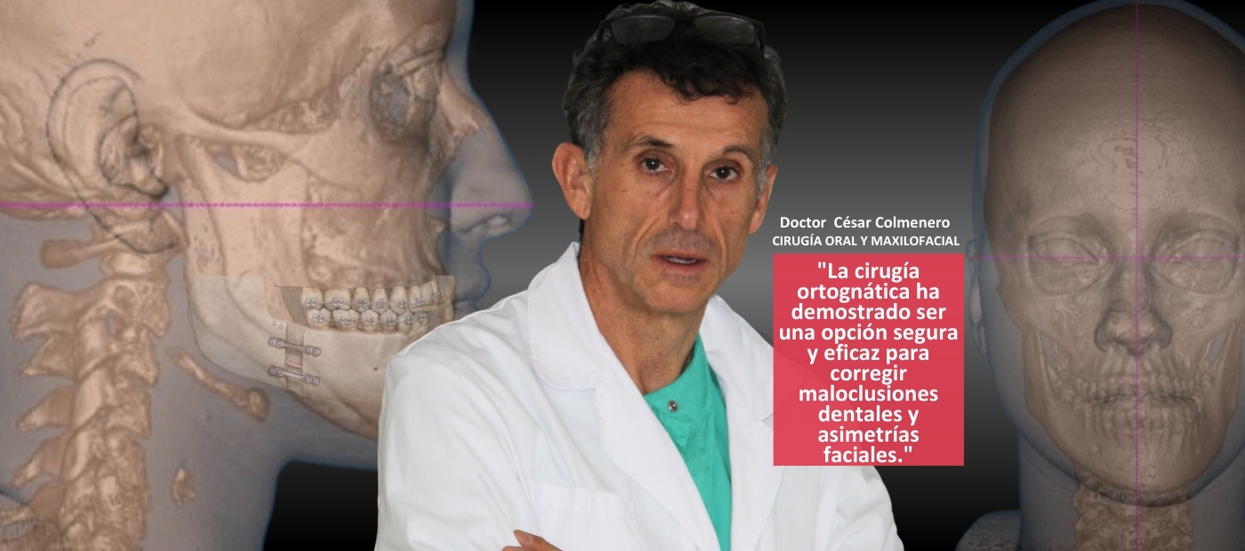 Cirugía ortognática