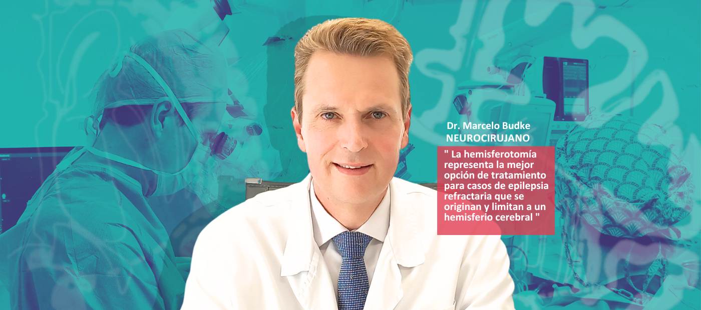 Hemisferotomia Cirugía de la epilepsia