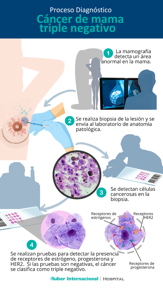 Cáncer de mama triple negativo Hospital Ruber Internacional Mirasierra