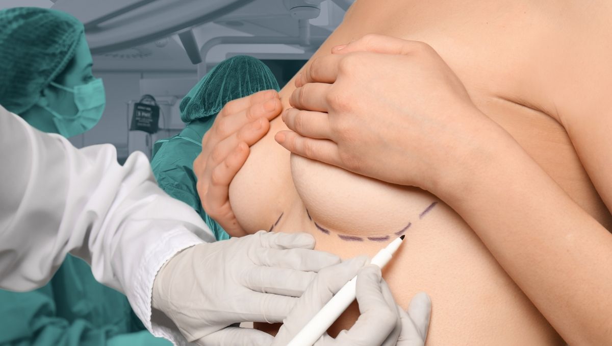 reconstrucción mamaria autologa implantes mastectomia
