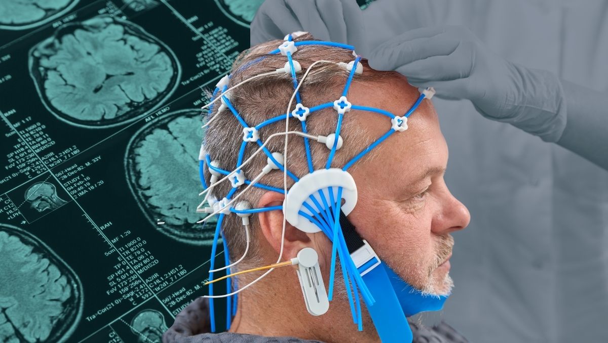 Tratamiento de la epilepsia refractaria (2)
