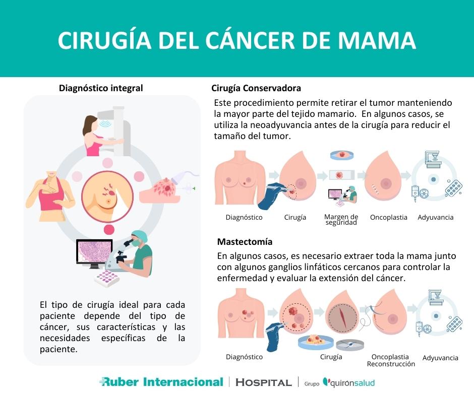 cirugia del cancer de mama