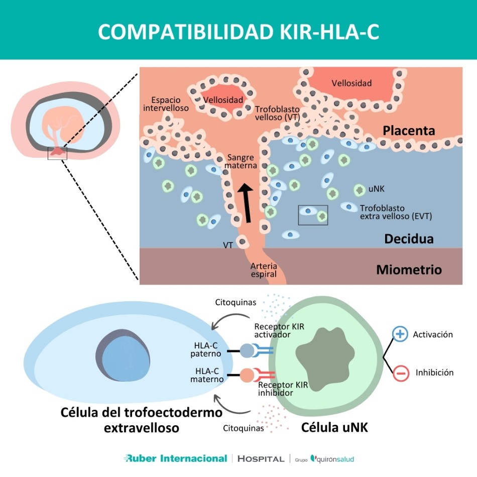 Compatibilidad KIR-HLAC madre embrion embarazo