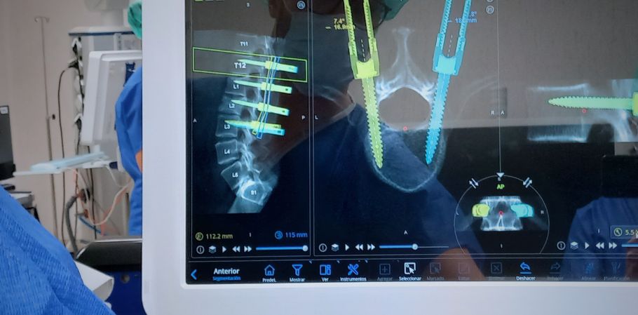 Unidad de patología vertebral