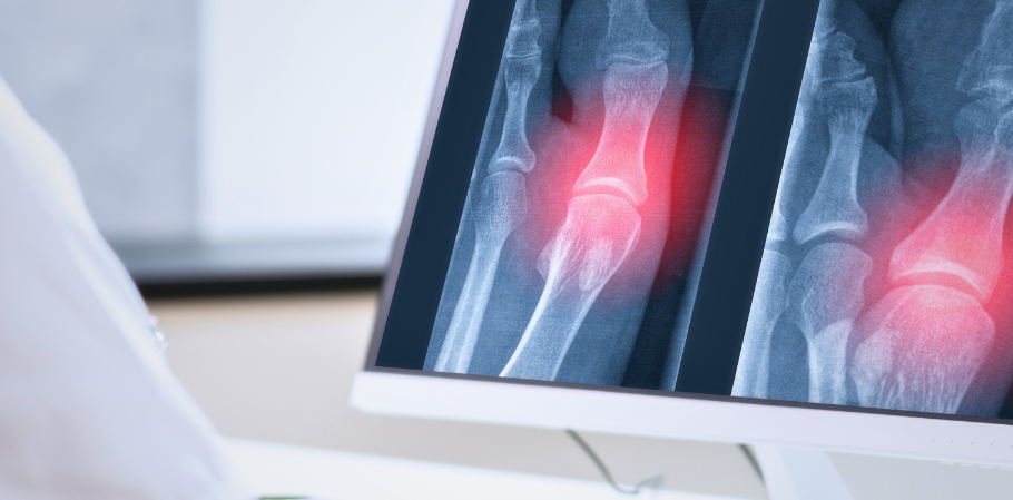 Unidad de sarcoma Ruber