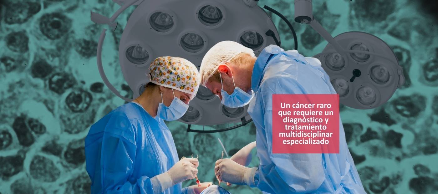 Sarcoma Diagnostico Tratamiento