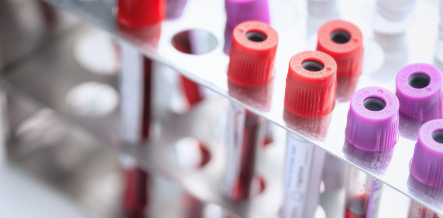 Laboratorio Ruber Internacional